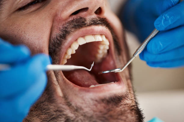 Best Same-Day Emergency Dentist in Seven Points, TX